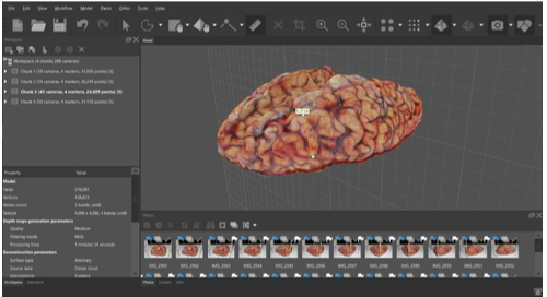 Renderización 3D de cortes de encéfalo