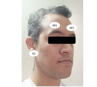 Ubicación de Electrodos para EEG según Sistema Internacional 10-20.